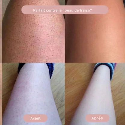 Épilateur Doux – Peau Lisse Sans Irritations